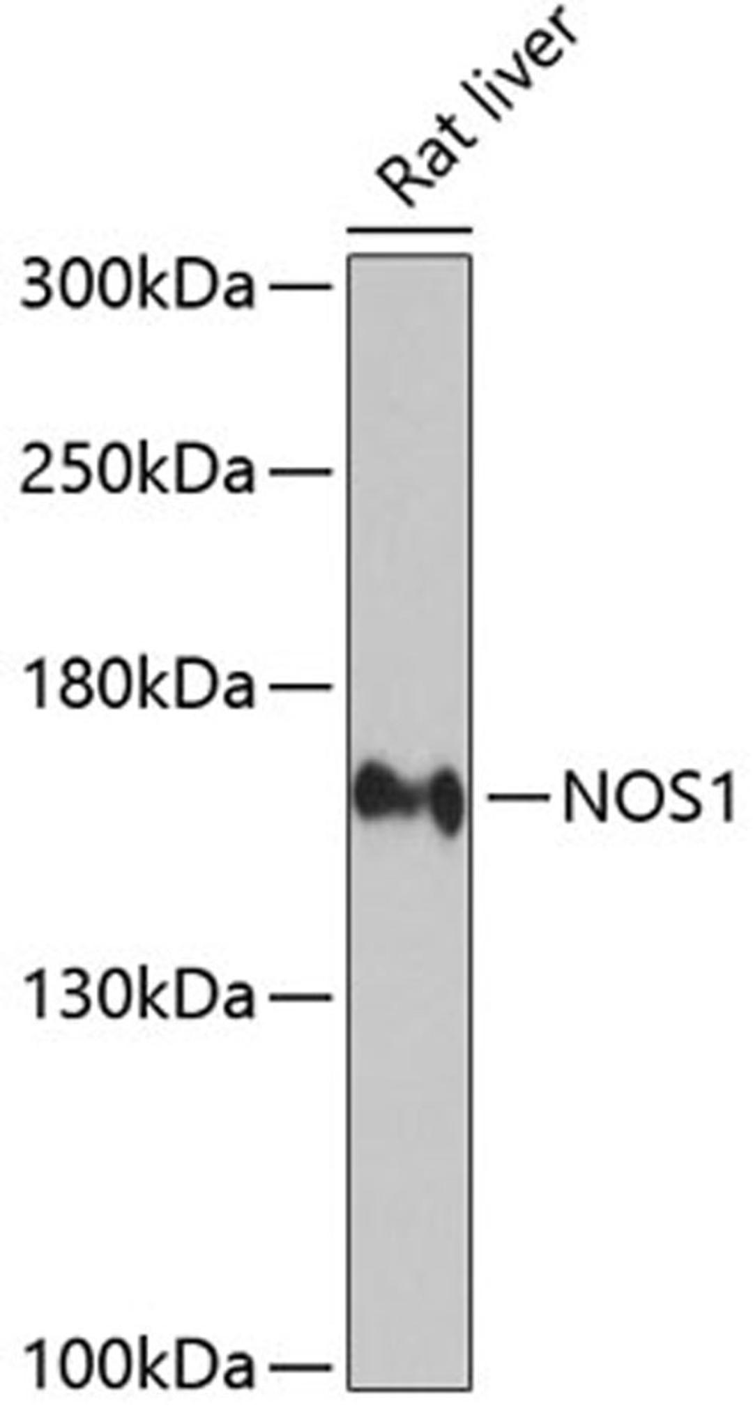 Western blot - NOS1 antibody (A1485)