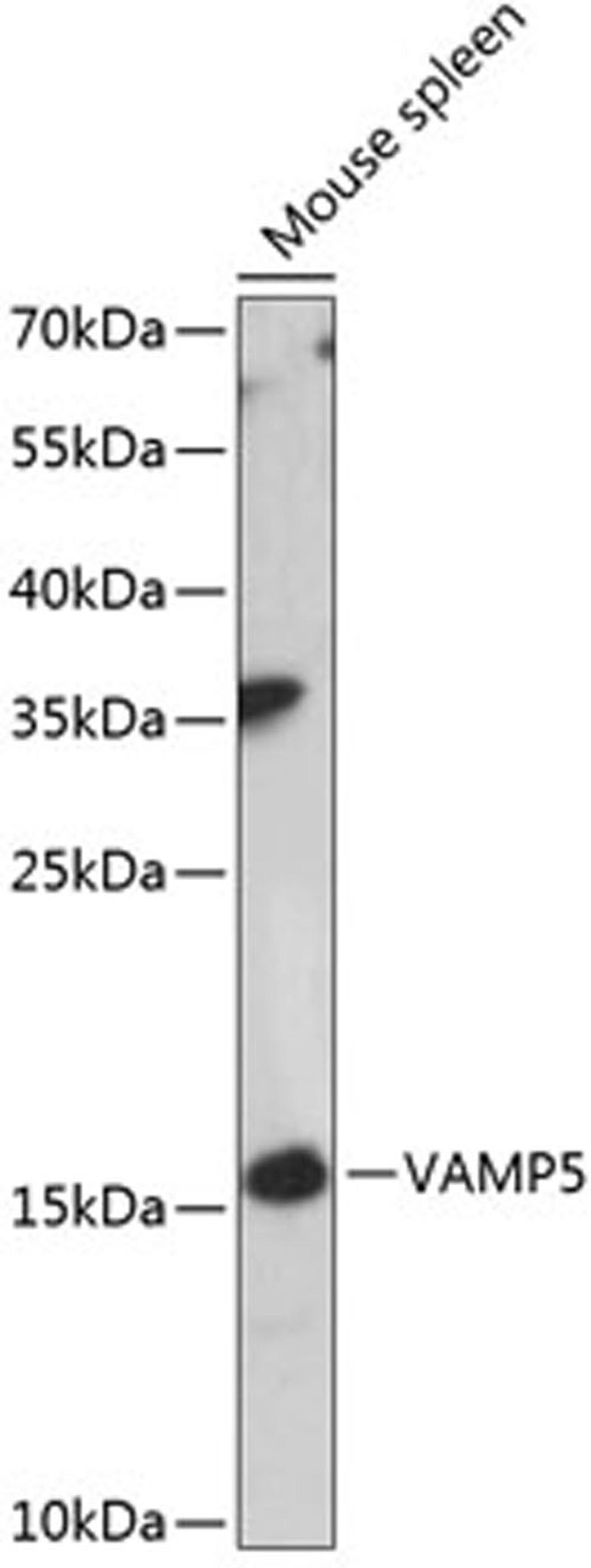 Western blot - VAMP5 antibody (A14371)