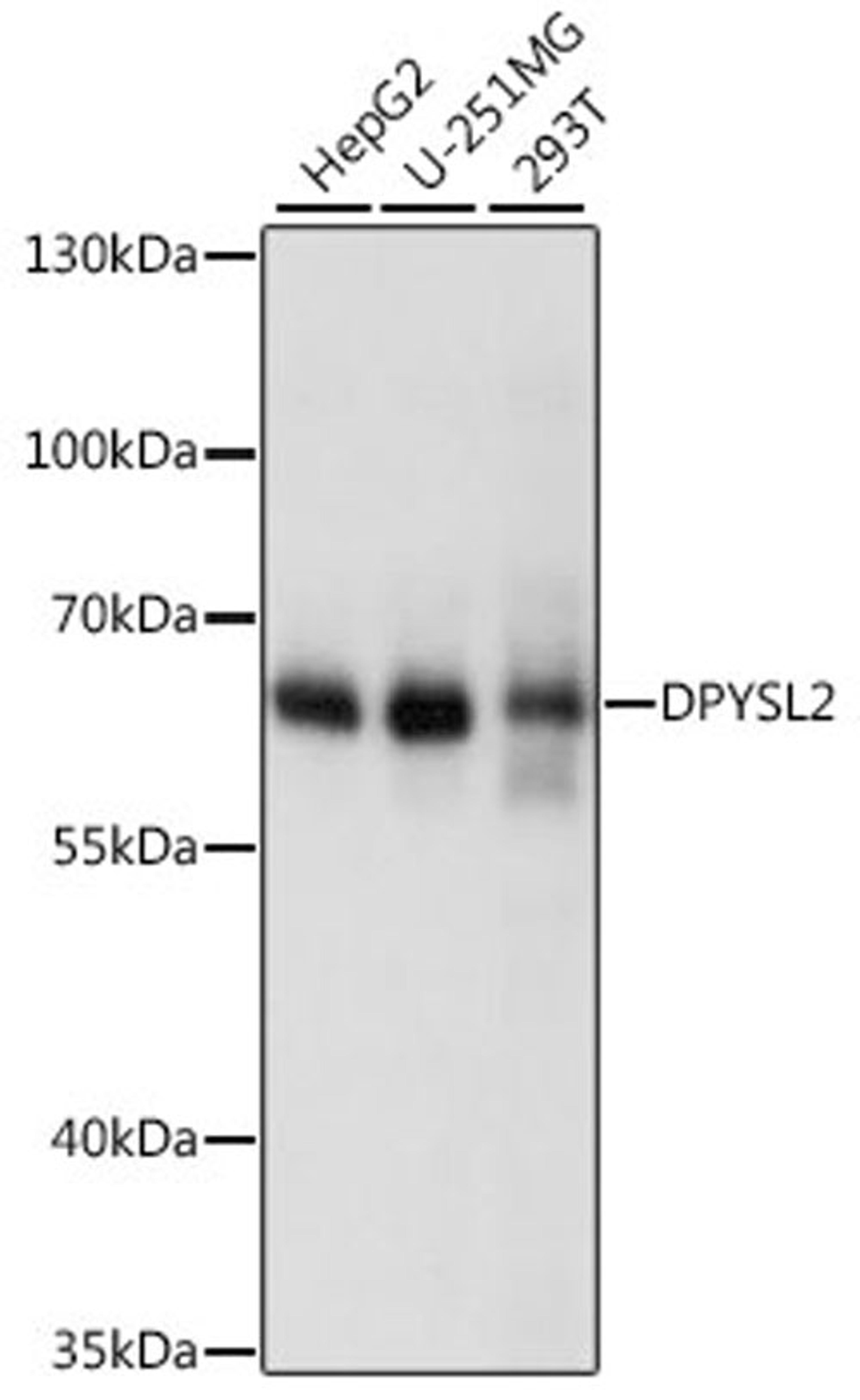 Western blot - DPYSL2 antibody (A14570)