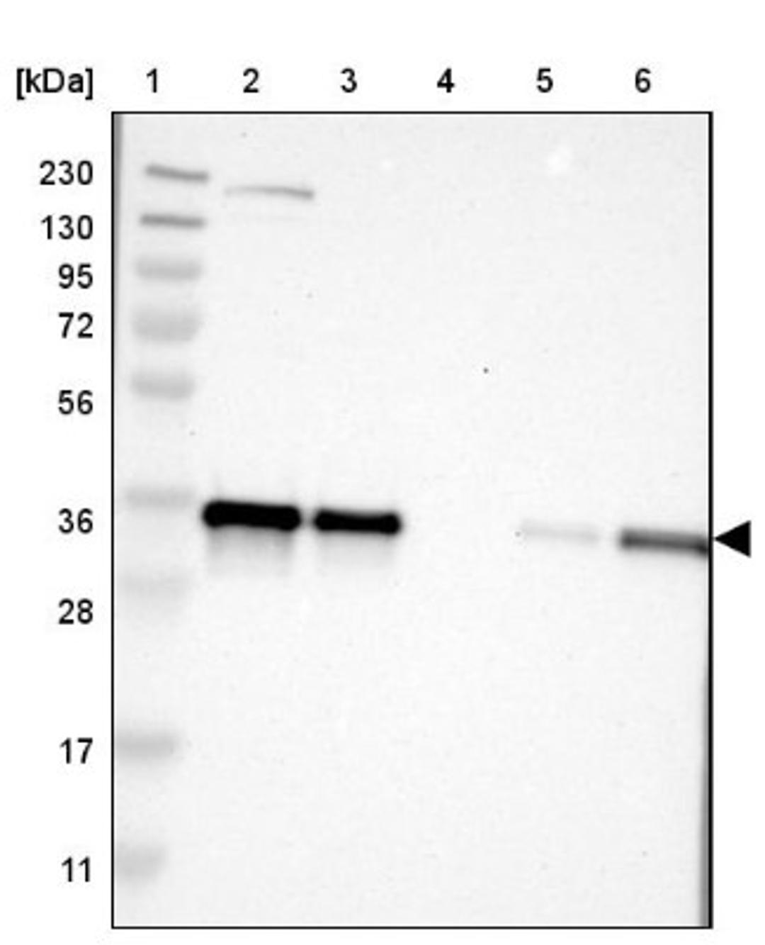 Western Blot: KCTD10 Antibody [NBP1-81023] - Lane 1: Marker [kDa] 230, 130, 95, 72, 56, 36, 28, 17, 11<br/>Lane 2: Human cell line RT-4<br/>Lane 3: Human cell line U-251MG sp<br/>Lane 4: Human plasma (IgG/HSA depleted)<br/>Lane 5: Human liver tissue<br/>Lane 6: Human tonsil tissue