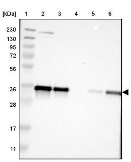 Western Blot: KCTD10 Antibody [NBP1-81023] - Lane 1: Marker [kDa] 230, 130, 95, 72, 56, 36, 28, 17, 11<br/>Lane 2: Human cell line RT-4<br/>Lane 3: Human cell line U-251MG sp<br/>Lane 4: Human plasma (IgG/HSA depleted)<br/>Lane 5: Human liver tissue<br/>Lane 6: Human tonsil tissue