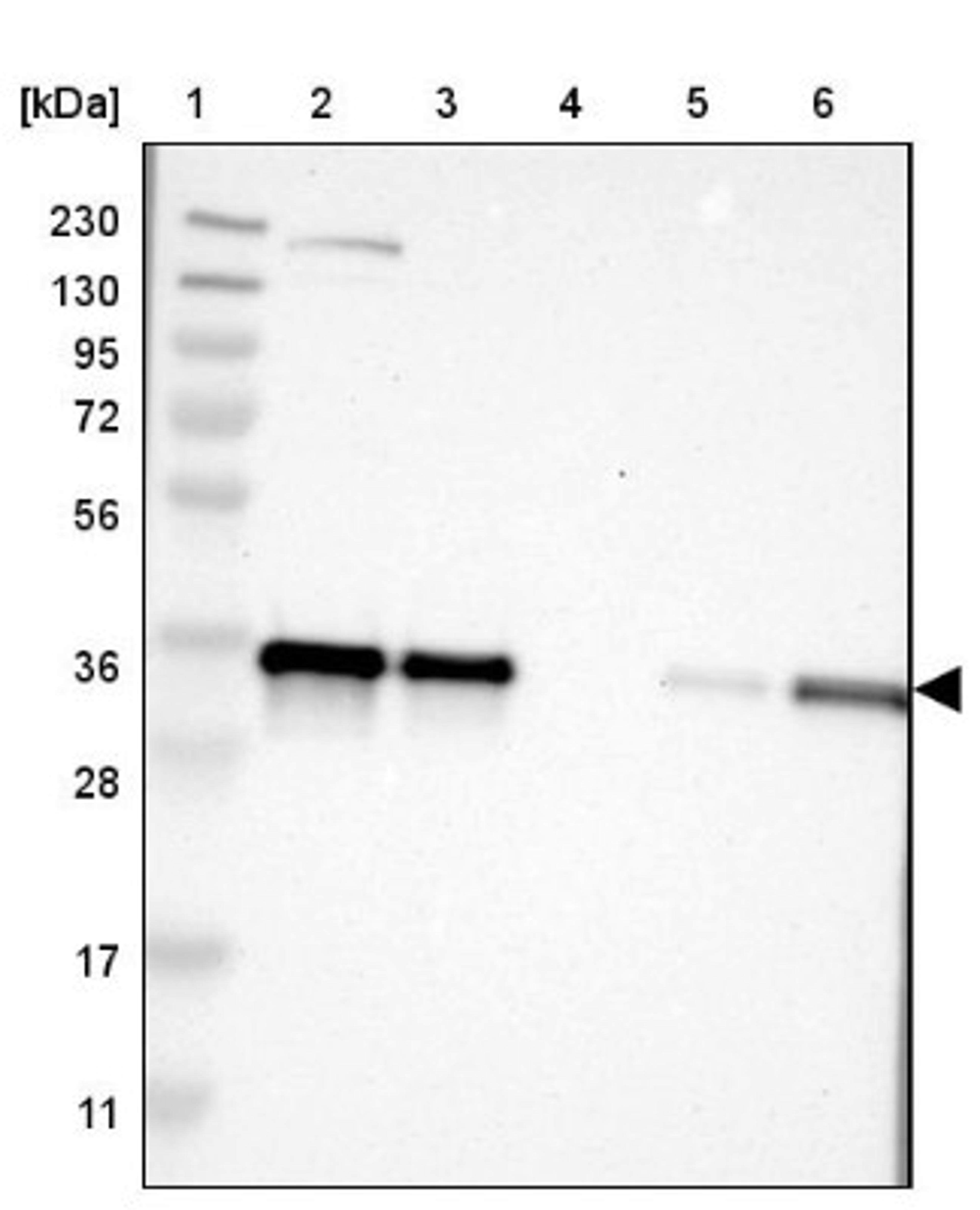 Western Blot: KCTD10 Antibody [NBP1-81023] - Lane 1: Marker [kDa] 230, 130, 95, 72, 56, 36, 28, 17, 11<br/>Lane 2: Human cell line RT-4<br/>Lane 3: Human cell line U-251MG sp<br/>Lane 4: Human plasma (IgG/HSA depleted)<br/>Lane 5: Human liver tissue<br/>Lane 6: Human tonsil tissue