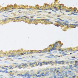 Immunohistochemistry - TSHB antibody (A6780)