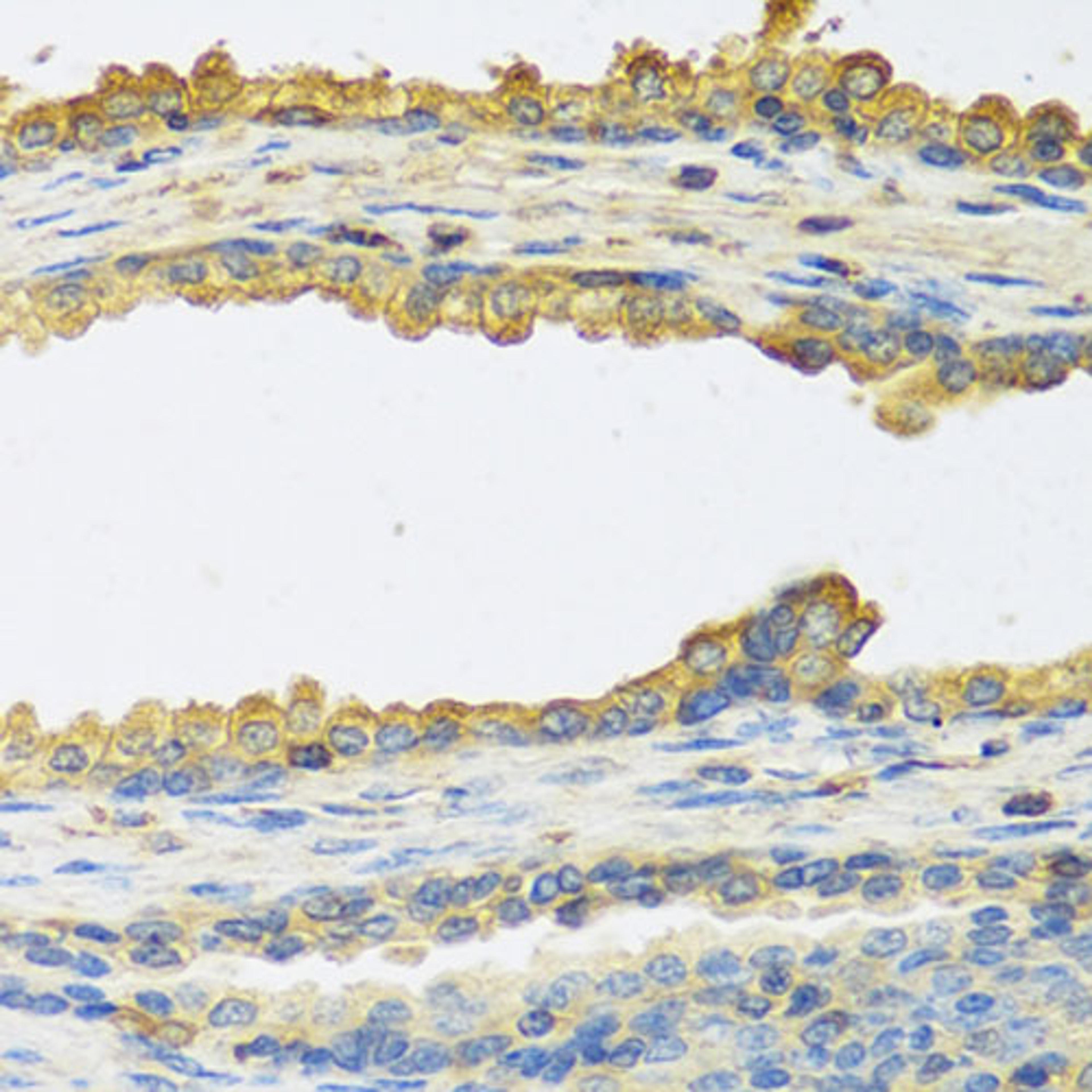 Immunohistochemistry - TSHB antibody (A6780)