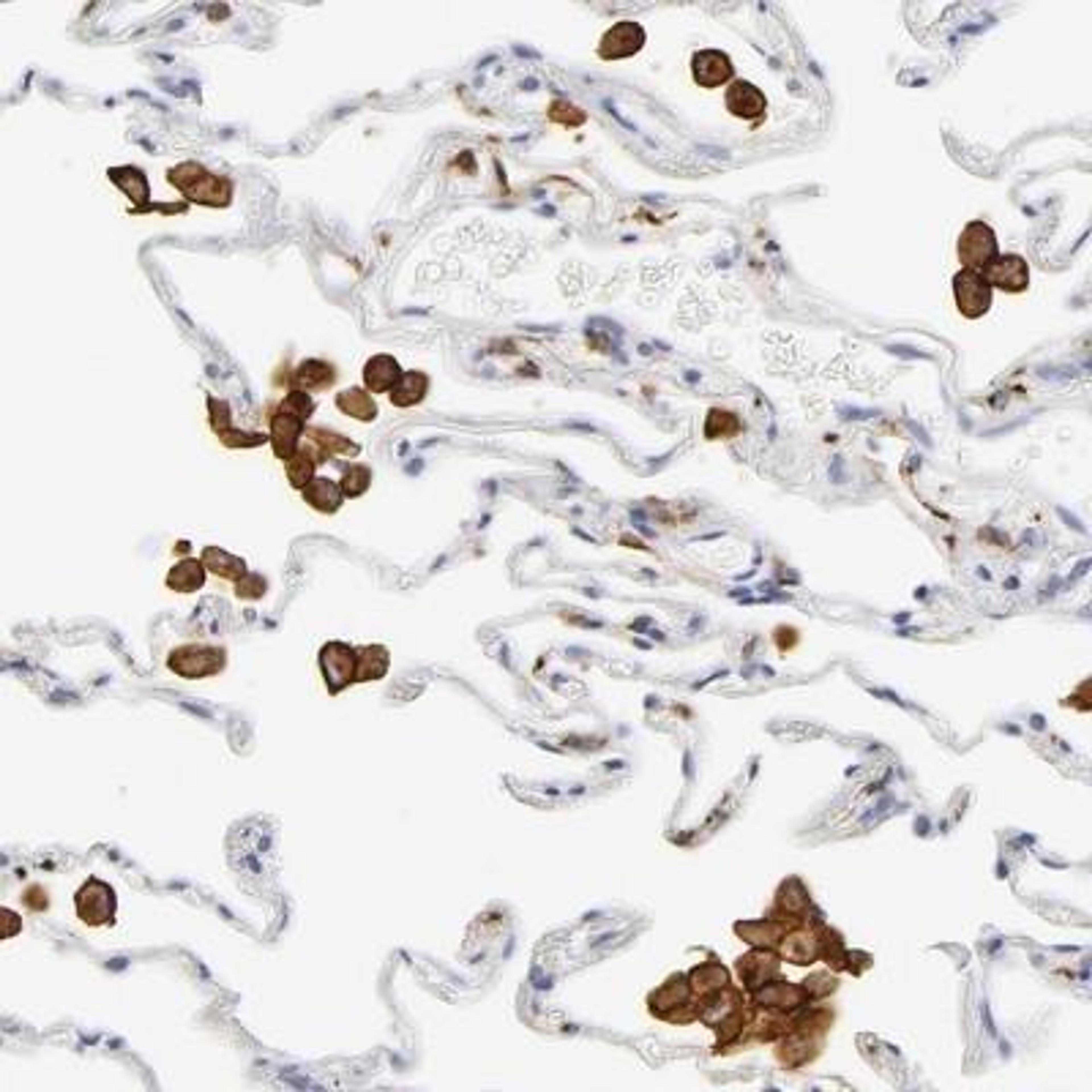 Immunohistochemistry-Paraffin: MMR/CD206/Mannose Receptor Antibody [NBP1-90020] - Staining of human lung shows strong cytoplasmic and membranous positivity in macrophages.