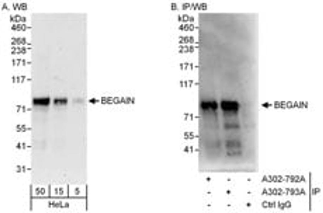 Detection of human BEGAIN by western blot and immunoprecipitation.