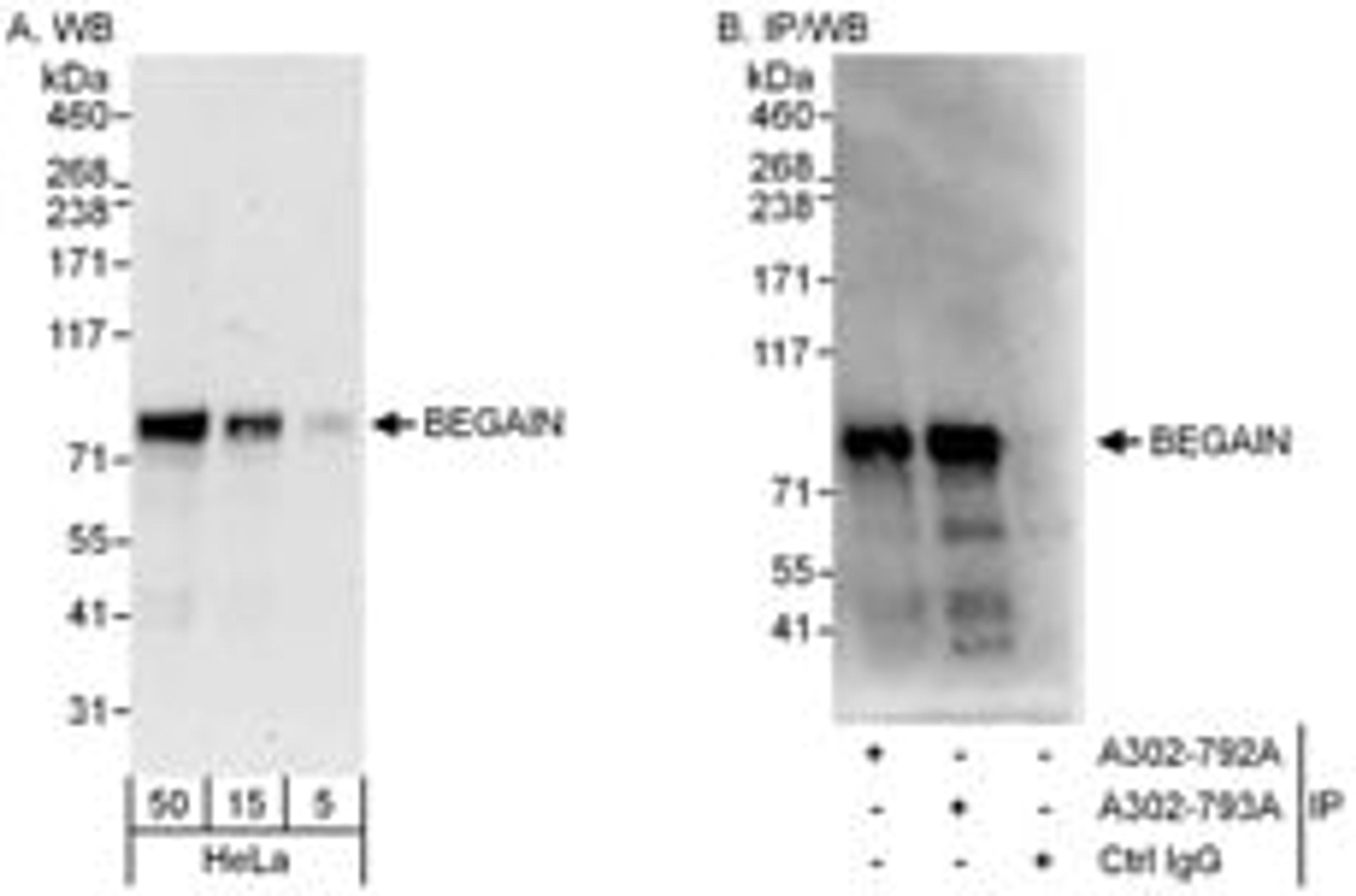 Detection of human BEGAIN by western blot and immunoprecipitation.