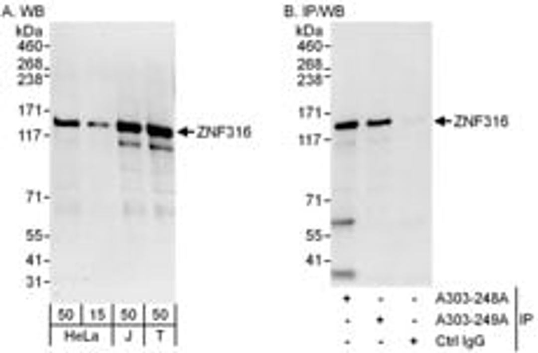 Detection of human ZNF316 by western blot and immunoprecipitation.