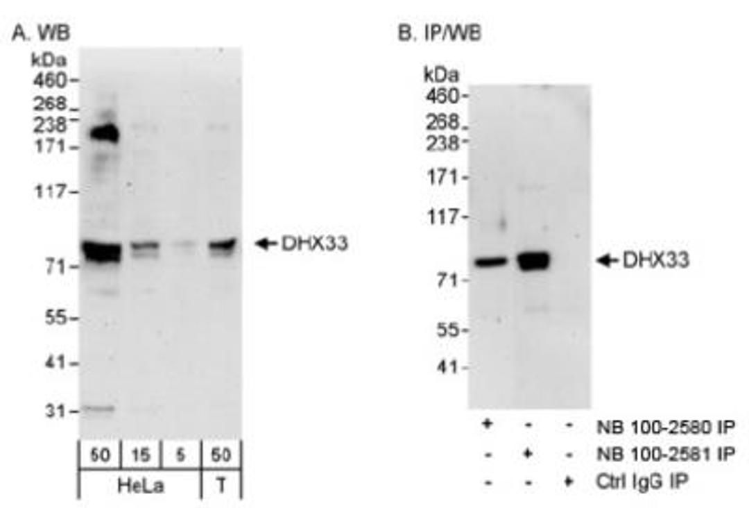 Western Blot: DHX33 Antibody [NB100-2581] - Detection of Human DHX33 on HeLa whole cell lystate using NB100-2581. DHX33 was also immunoprecipitated by rabbit anti-DHX33 antibody NB100-2580.