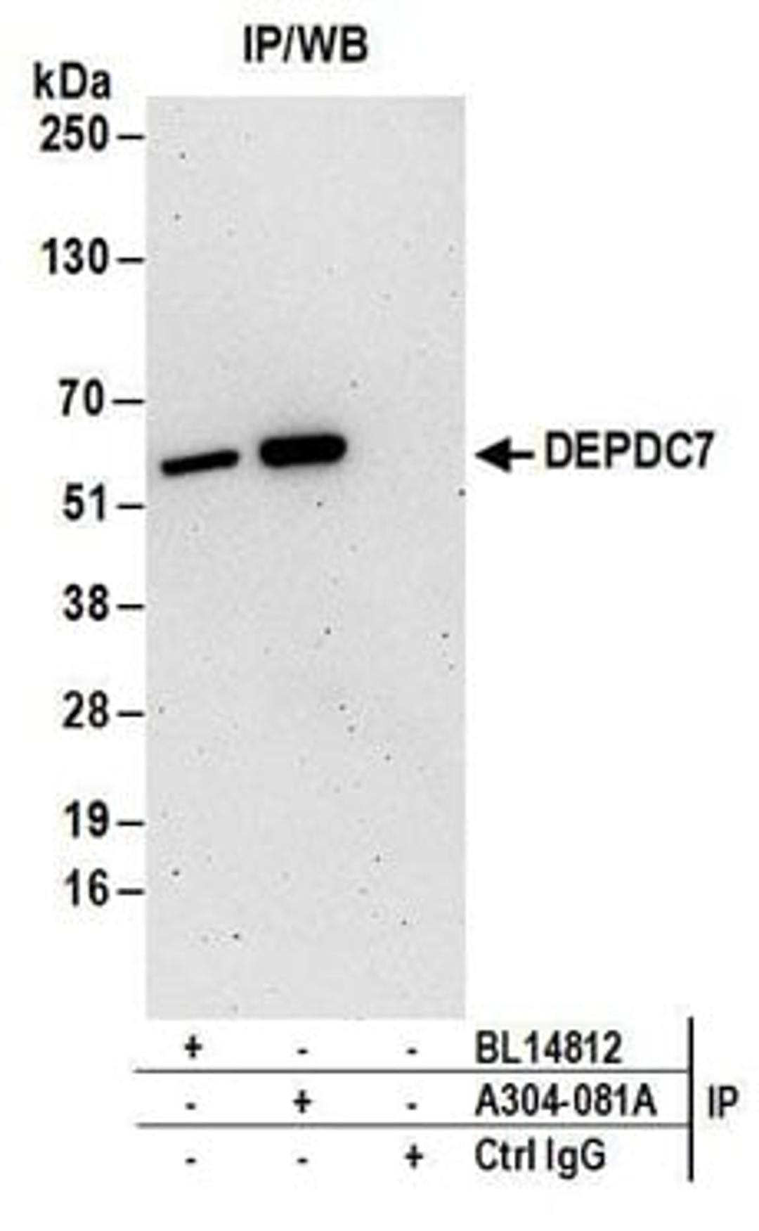 Detection of human DEPDC7 by western blot of immunoprecipitates.