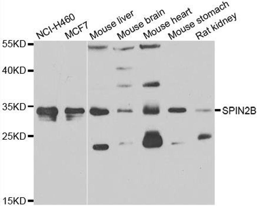 Western blot analysis of extracts of various cell lines using SPIN2B antibody