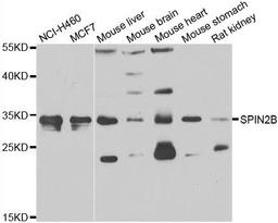 Western blot analysis of extracts of various cell lines using SPIN2B antibody