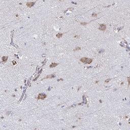 Immunohistochemistry: TMEM241 Antibody [NBP2-32503] - Staining of human cerebral cortex shows moderate cytoplasmic positivity in neuronal cells.