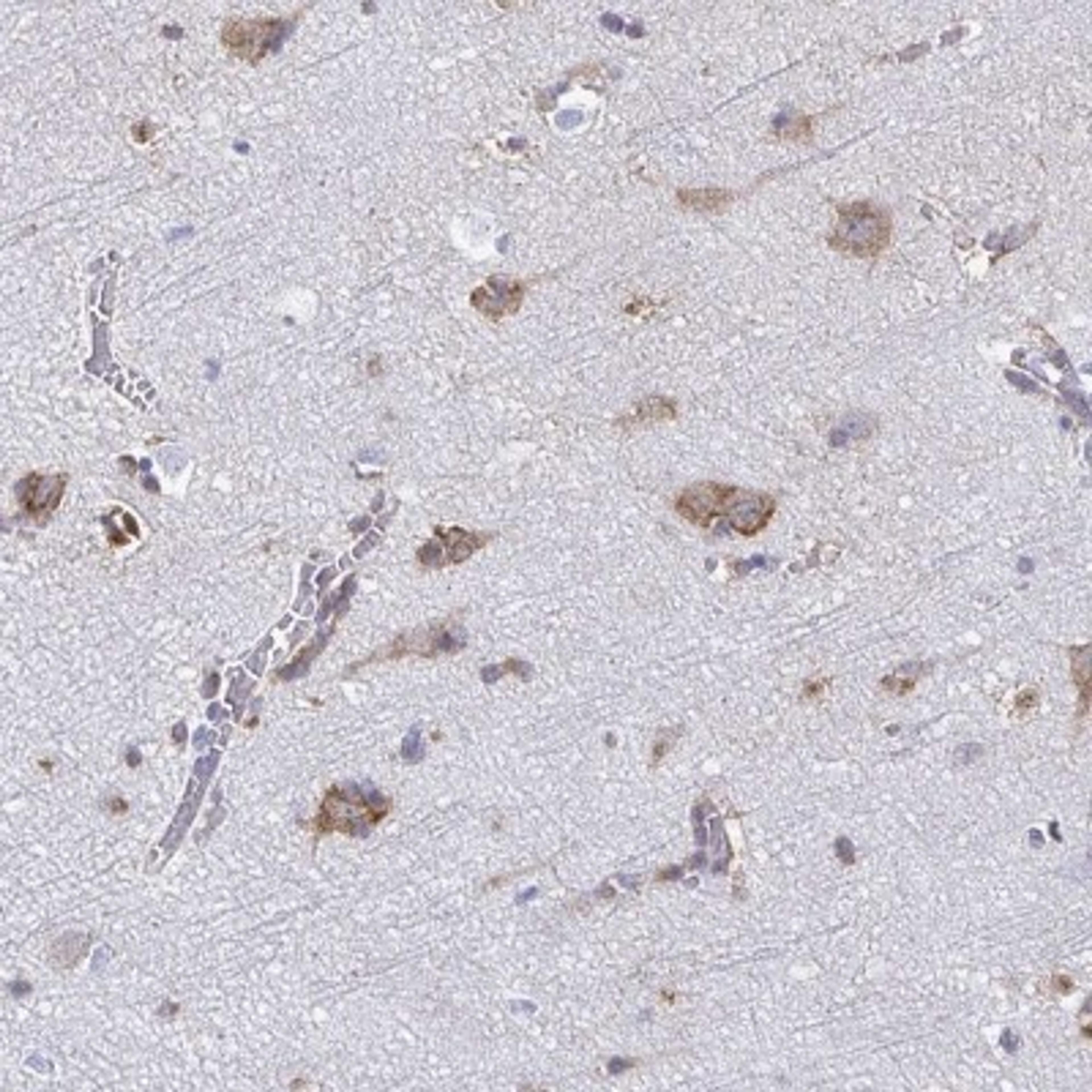 Immunohistochemistry: TMEM241 Antibody [NBP2-32503] - Staining of human cerebral cortex shows moderate cytoplasmic positivity in neuronal cells.