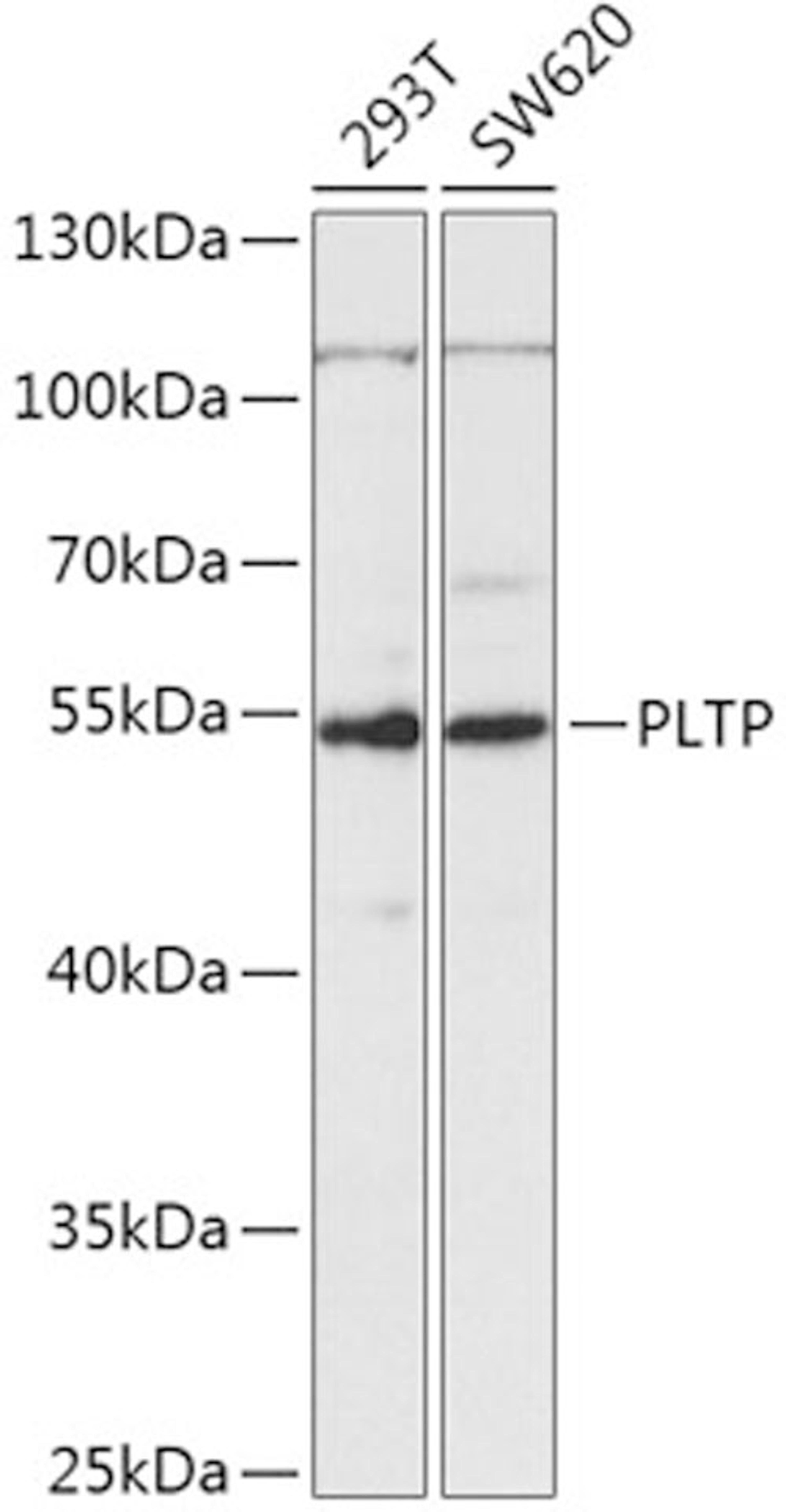 Western blot - PLTP antibody (A5628)