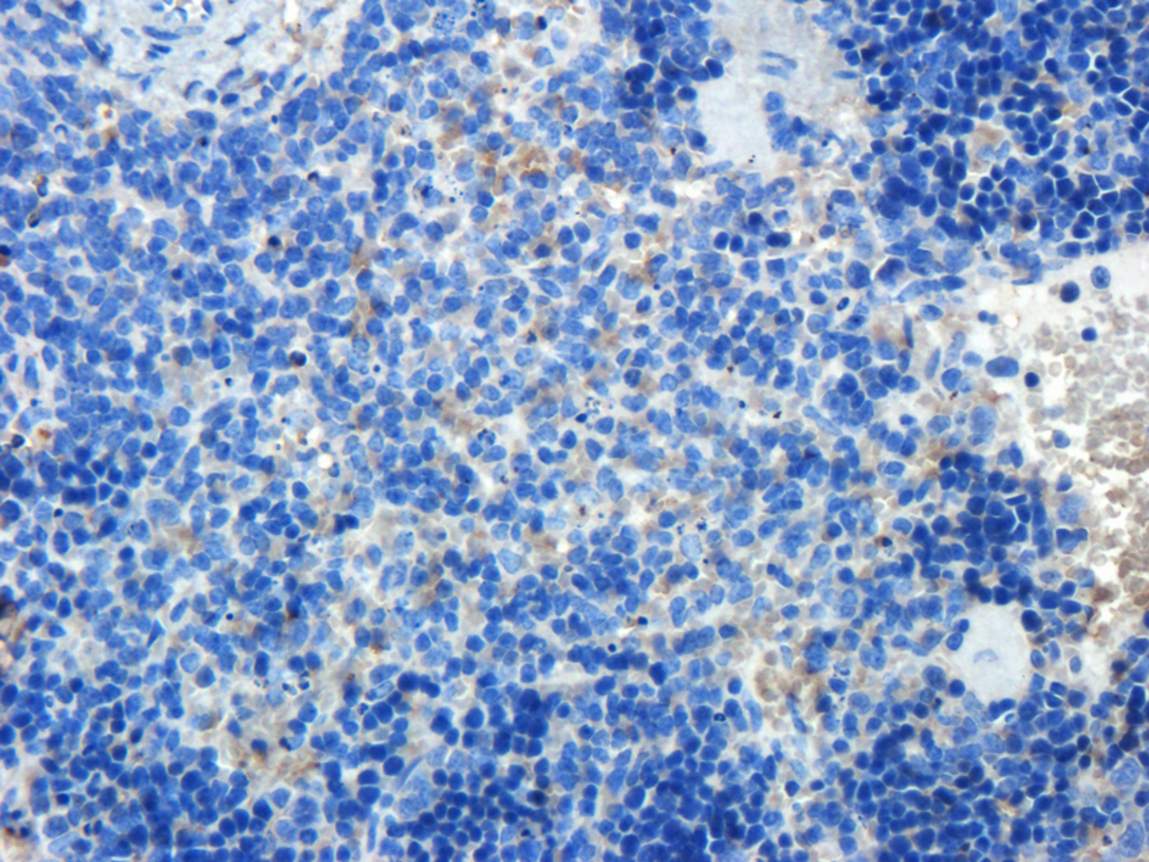 IHC-P image of rat spleen tissue using CD8 antibody (2.5 ug/ml)