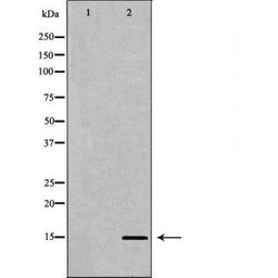 Western blot analysis of HeLa cell line and H3 protein expressed in E.coli using Histone H3K27me3 antibody