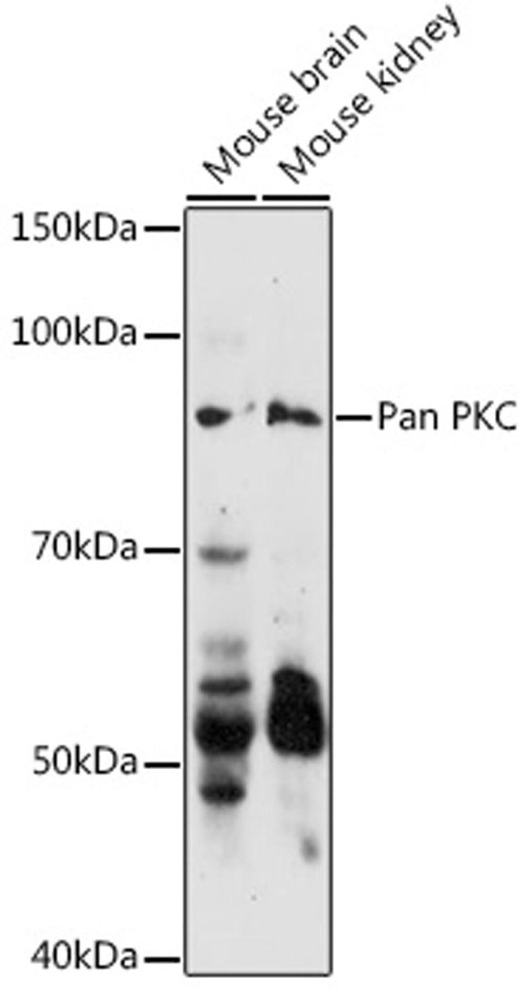 Western blot - Pan PKC antibody (A17921)