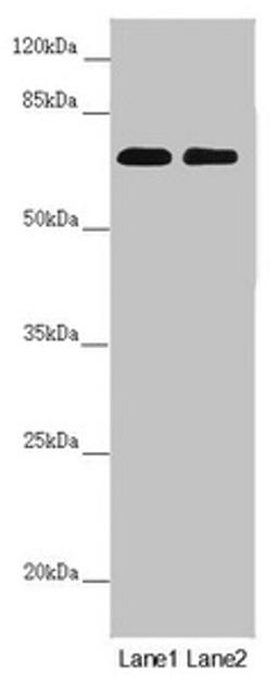 Western blot. All lanes: DYNC1I1 antibody at 1.97 ug/ml. Lane 1: Mouse brain tissue. Lane 2: Mouse gonadal tissue. Secondary. Goat polyclonal to rabbit IgG at 1/10000 dilution. Predicted band size: 73, 71, 69, 68 kDa. Observed band size: 73 kDa. 