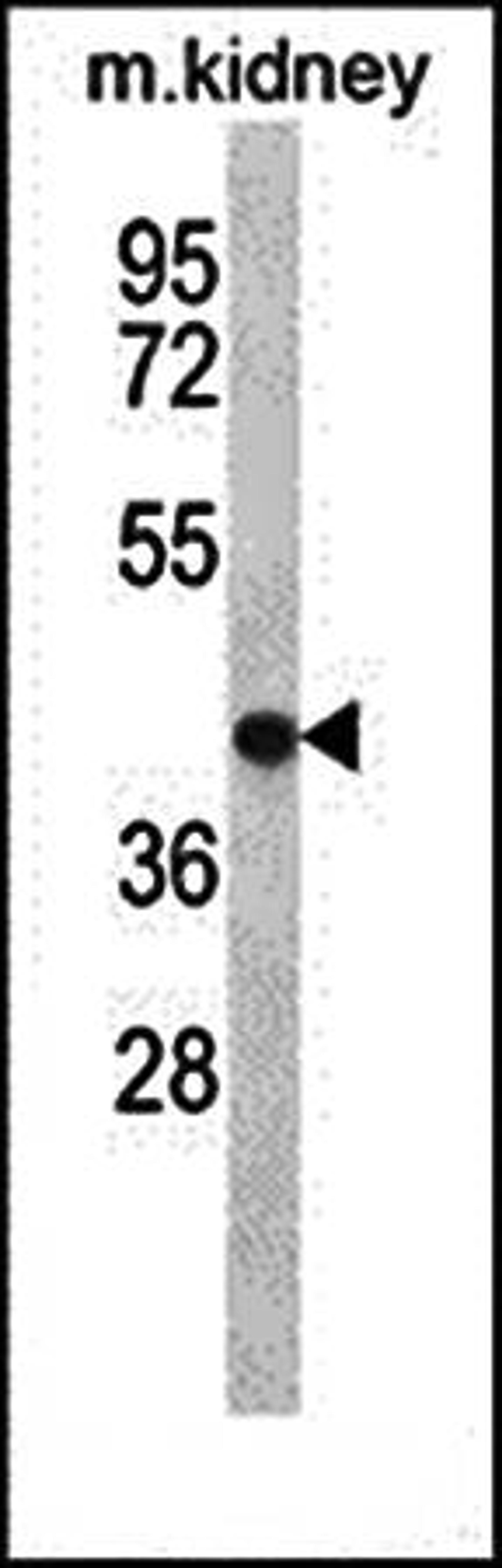 Western blot analysis of TNMD antibody in mouse kidney tissue lysates 