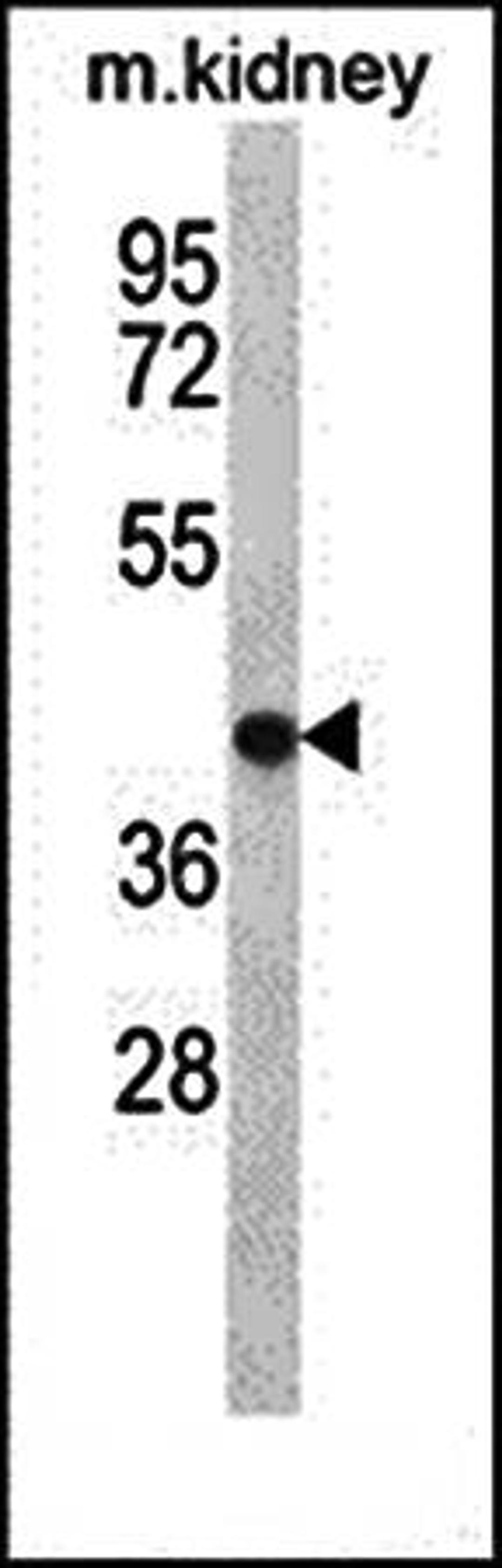 Western blot analysis of TNMD antibody in mouse kidney tissue lysates