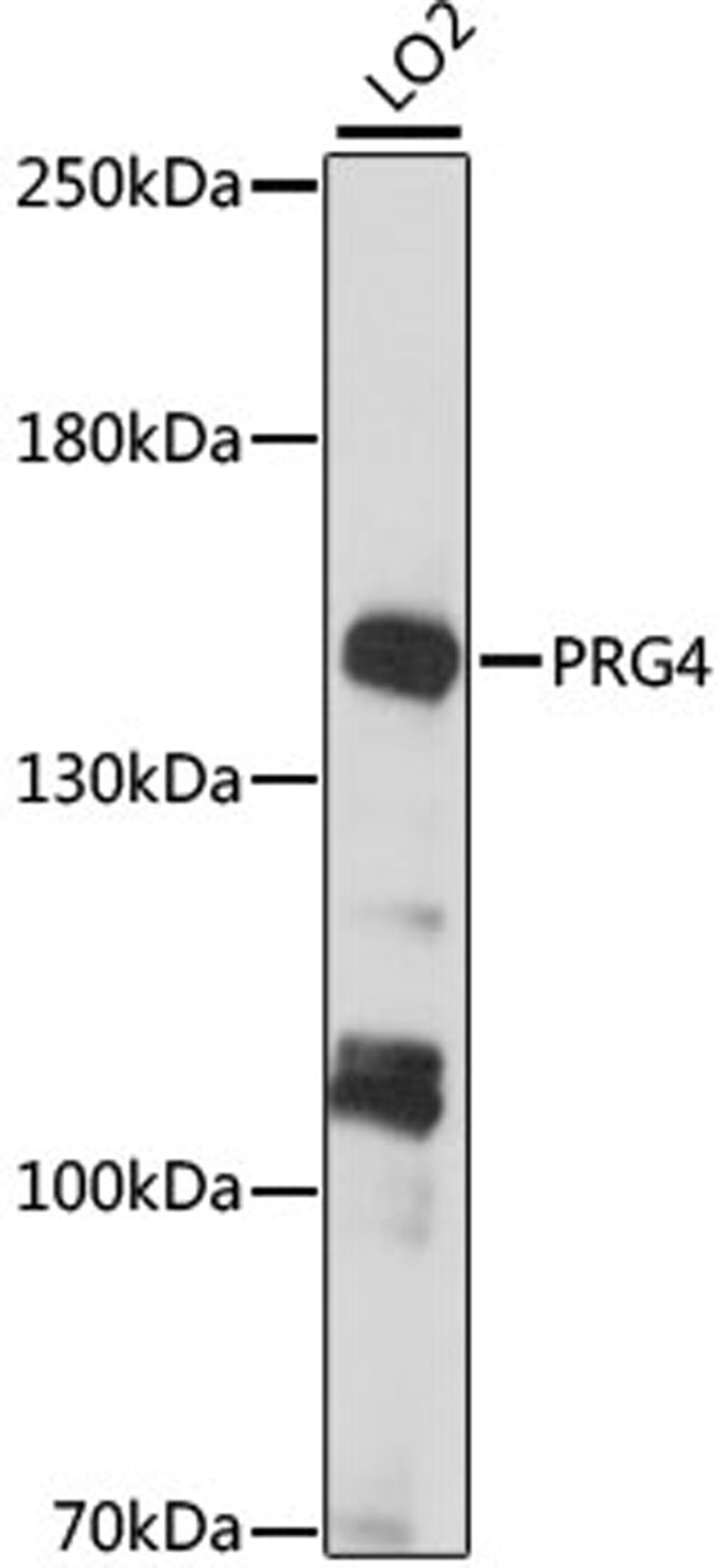 Western blot - PRG4 antibody (A15379)