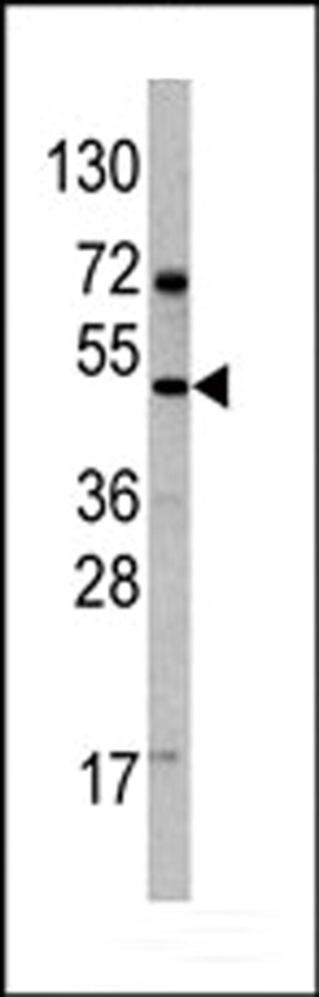 Western blot analysis of anti-VEGF4 Antibody Pab (AP6292b) in 293 cell line lysates.