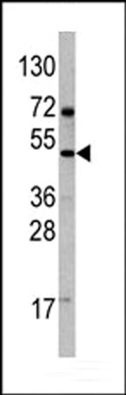 Western blot analysis of anti-VEGF4 Antibody Pab (AP6292b) in 293 cell line lysates.