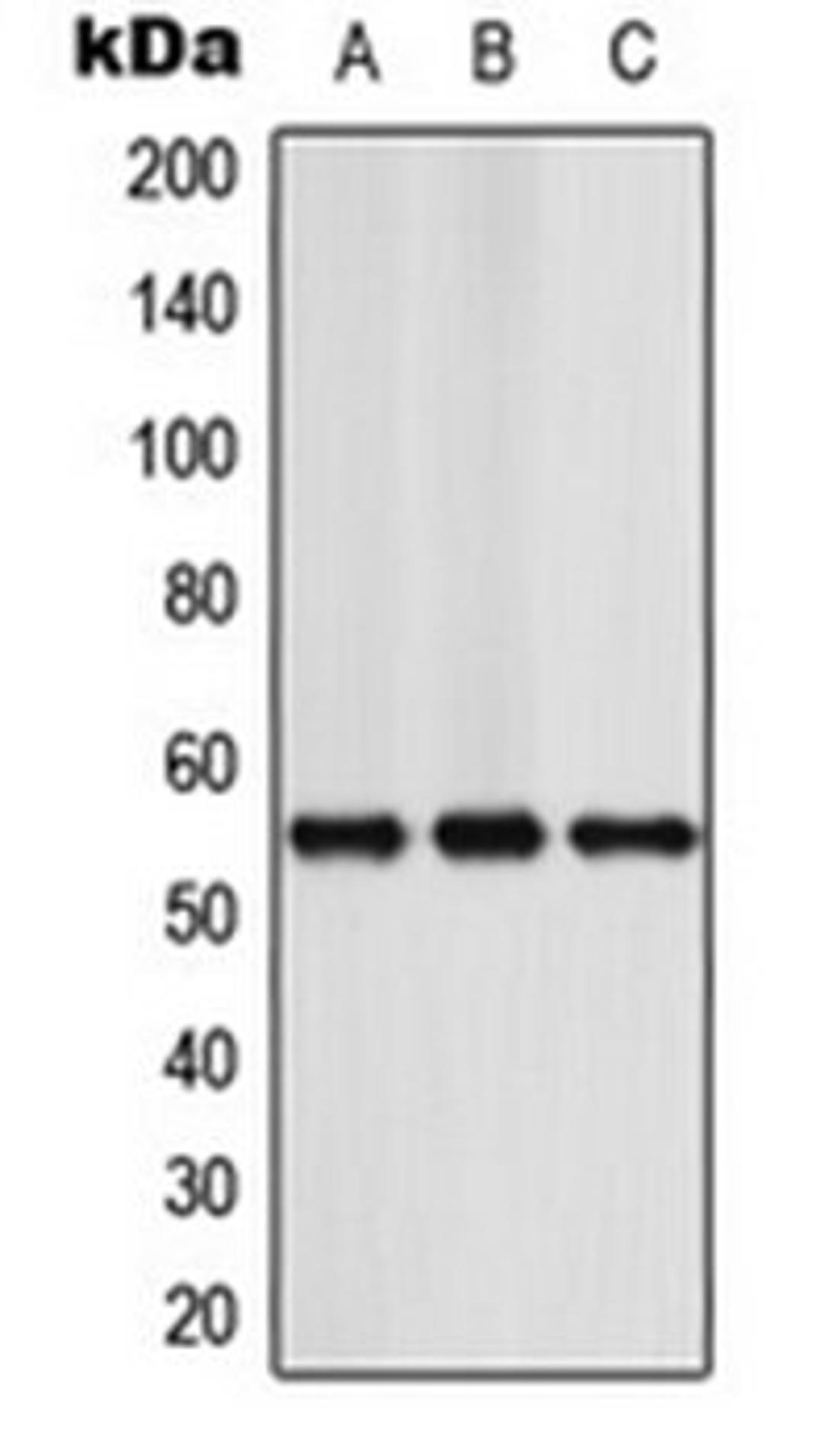 Western blot analysis of Jurkat (Lane 1), Raw264.7 (Lane 2), rat brain (Lane 3) whole cell lysates using NFIA antibody