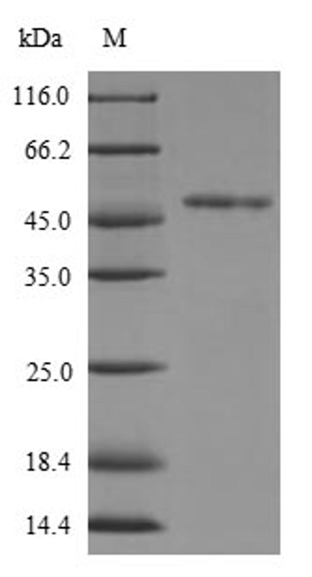 (Tris-Glycine gel) Discontinuous SDS-PAGE (reduced) with 5% enrichment gel and 15% separation gel.