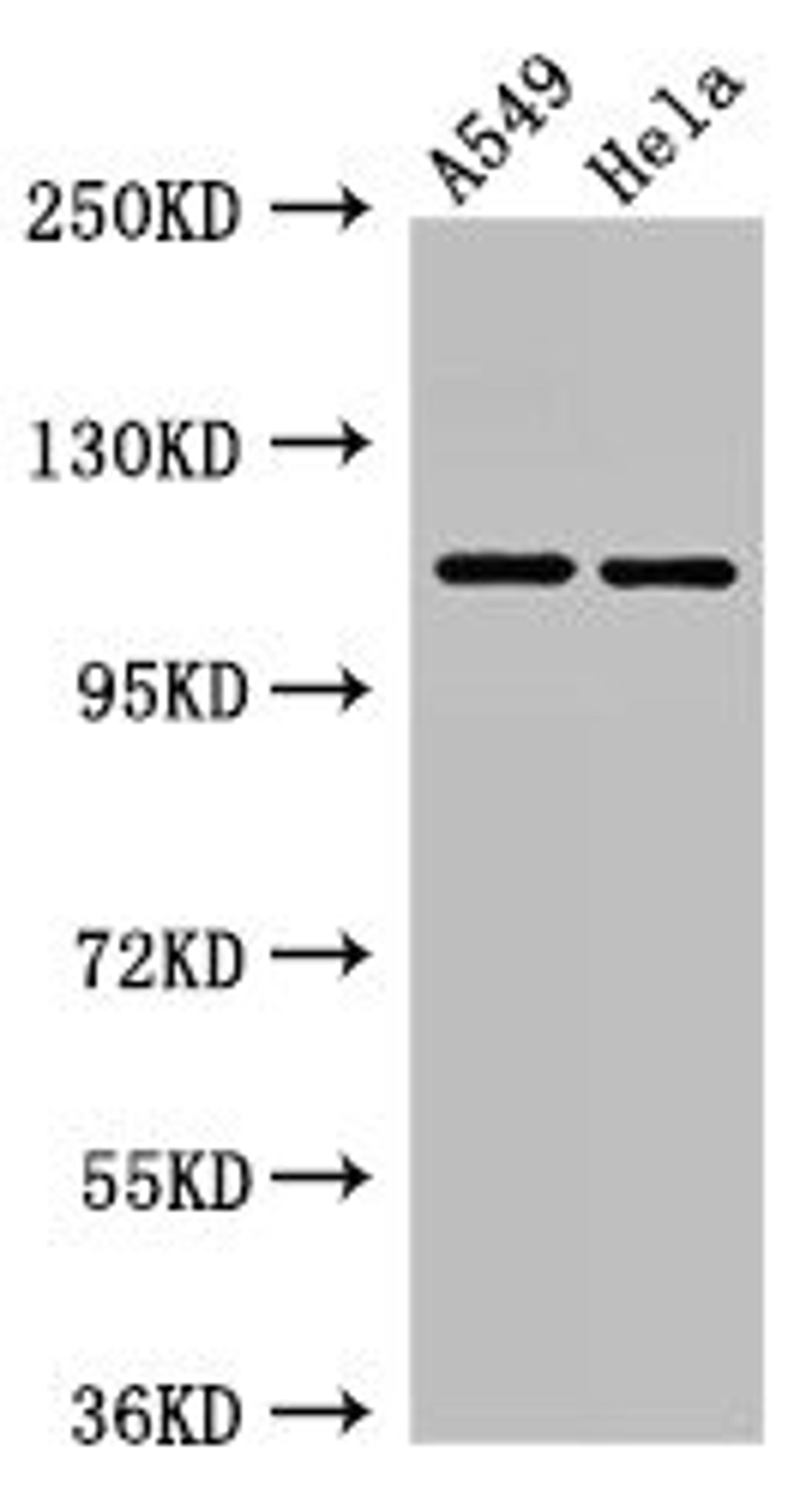 Western Blot. Positive WB detected in: A549 whole cell lysate, Hela whole cell lysate. All lanes: EPHA5 antibody at 3µg/ml. Secondary. Goat polyclonal to rabbit IgG at 1/50000 dilution. Predicted band size: 115, 113, 108 kDa. Observed band size: 115 kDa