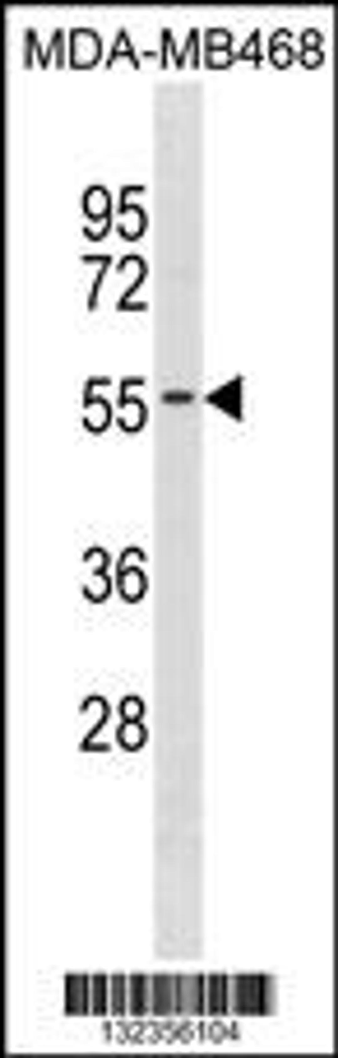 Western blot analysis in MDA-MB468 cell line lysates (35ug/lane).