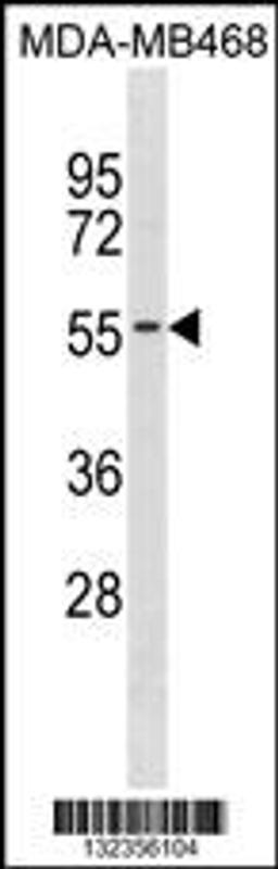 Western blot analysis in MDA-MB468 cell line lysates (35ug/lane).