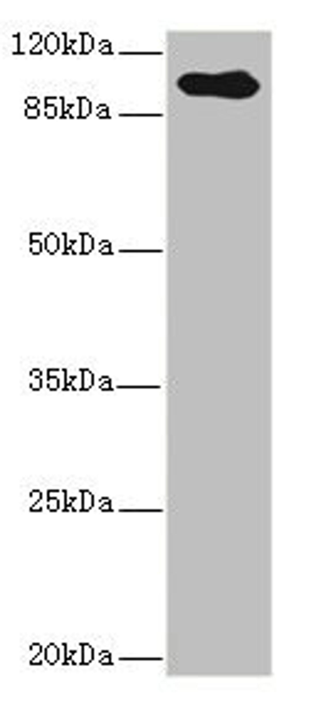 Western blot. All lanes: TGFBR3 antibody IgG at 2.39ug/ml + Hela whole cell lysate. Secondary. Goat polyclonal to rabbit IgG at 1/10000 dilution. Predicted band size: 93 kDa. Observed band size: 93 kDa.