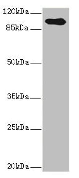 Western blot. All lanes: TGFBR3 antibody IgG at 2.39ug/ml + Hela whole cell lysate. Secondary. Goat polyclonal to rabbit IgG at 1/10000 dilution. Predicted band size: 93 kDa. Observed band size: 93 kDa.