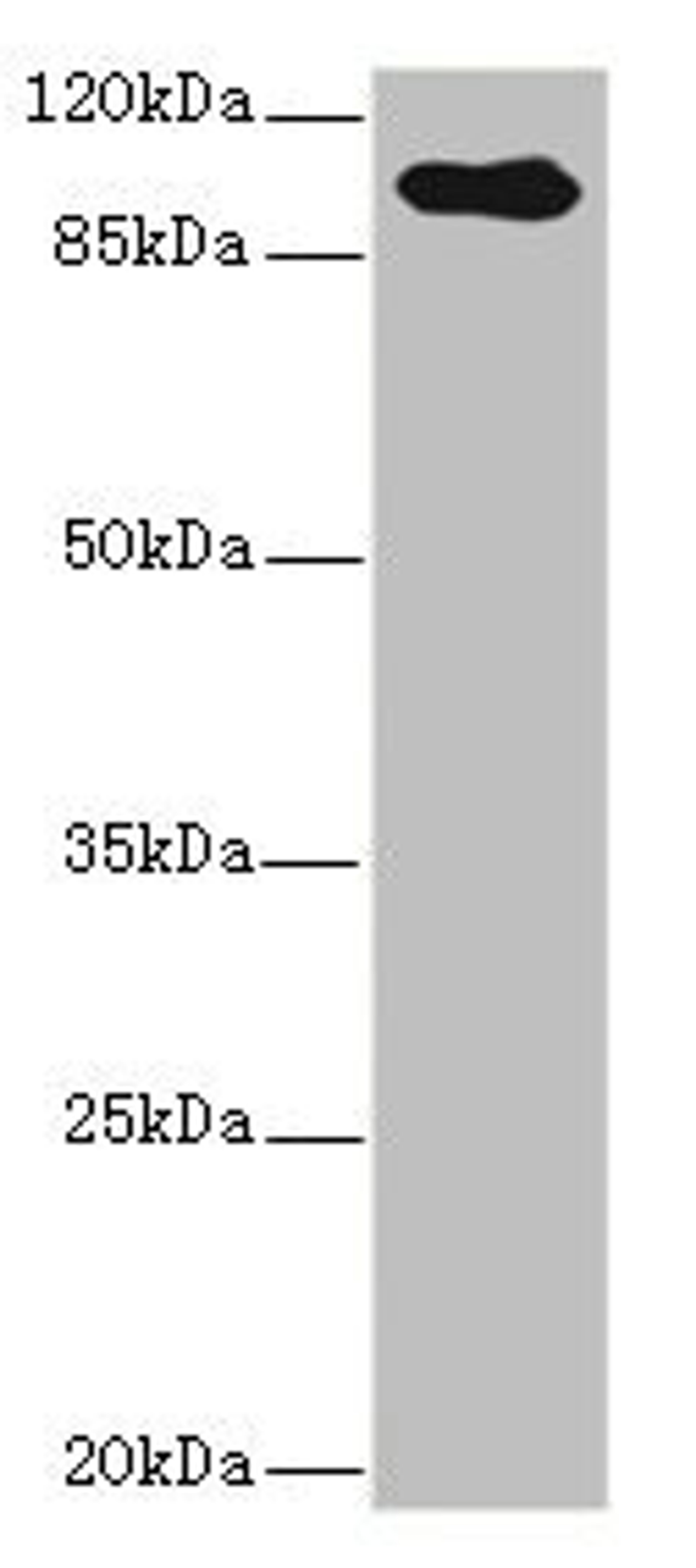 Western blot. All lanes: TGFBR3 antibody IgG at 2.39ug/ml + Hela whole cell lysate. Secondary. Goat polyclonal to rabbit IgG at 1/10000 dilution. Predicted band size: 93 kDa. Observed band size: 93 kDa.