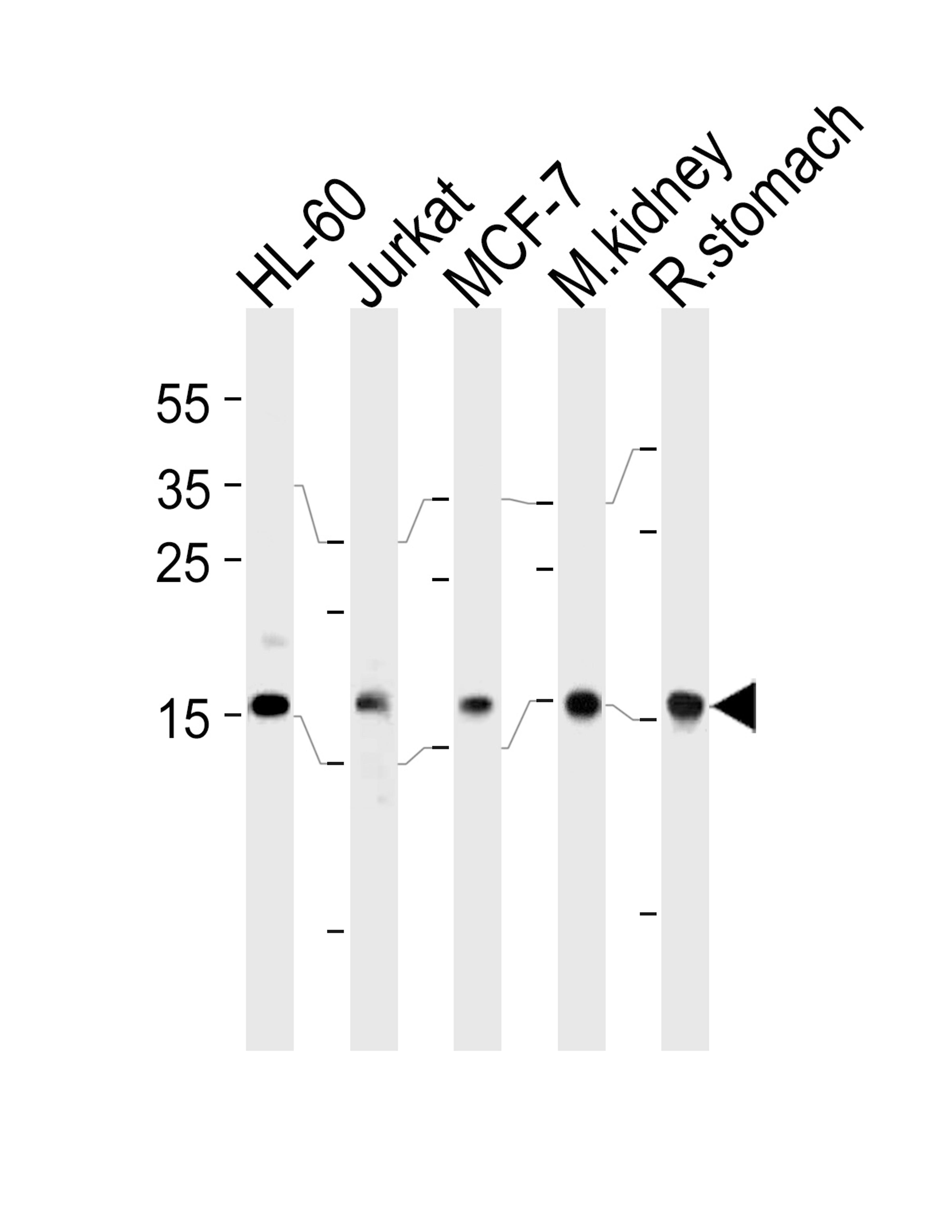 Western blot analysis in HL-60,Jurkat,MCF-7 cell line,mouse kidney and rat stomach tissue lysates (35ug/lane).