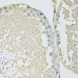 Immunohistochemistry  - SLC2A9 antibody (A14606)