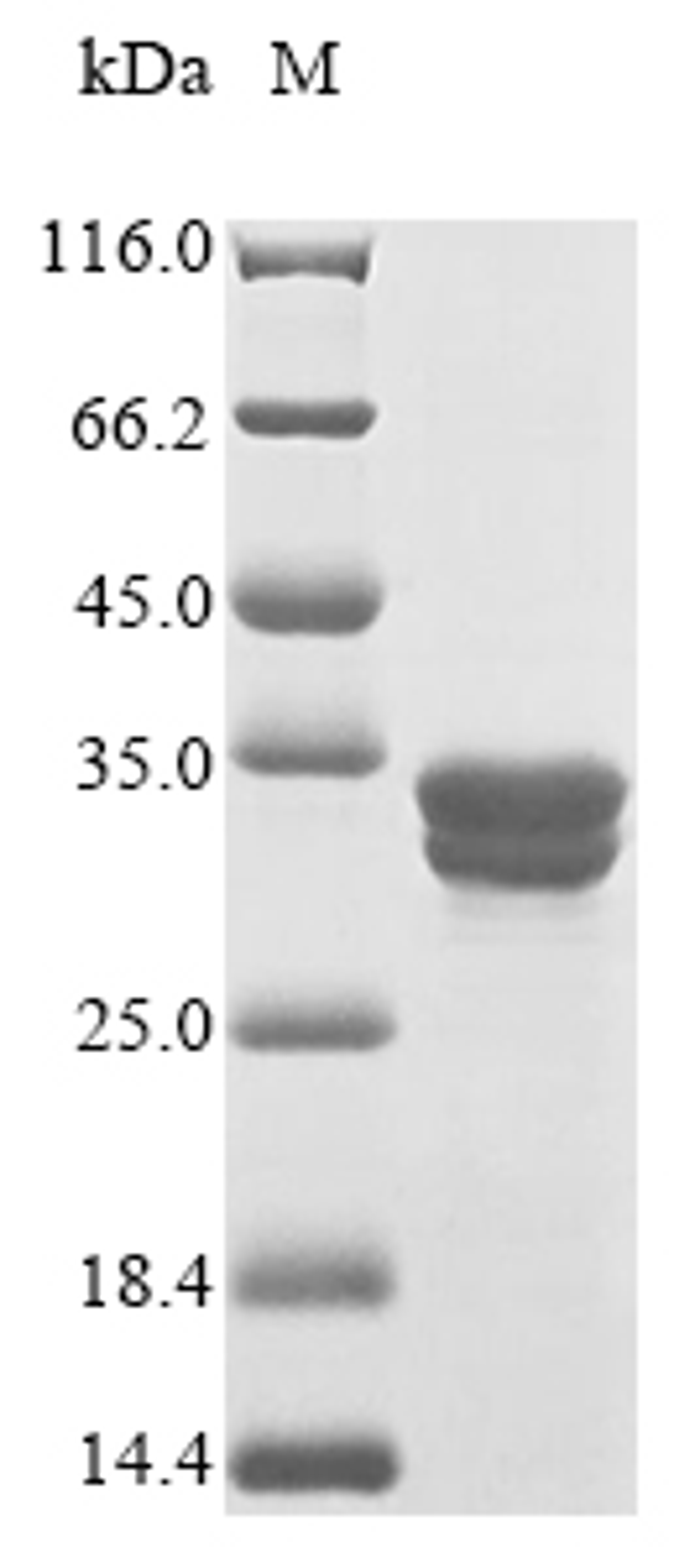 (Tris-Glycine gel) Discontinuous SDS-PAGE (reduced) with 5% enrichment gel and 15% separation gel.
