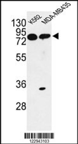 Western blot analysis of PRKAA1 Antibody in K562, MDA-MB435 cell line lysates (35ug/lane)