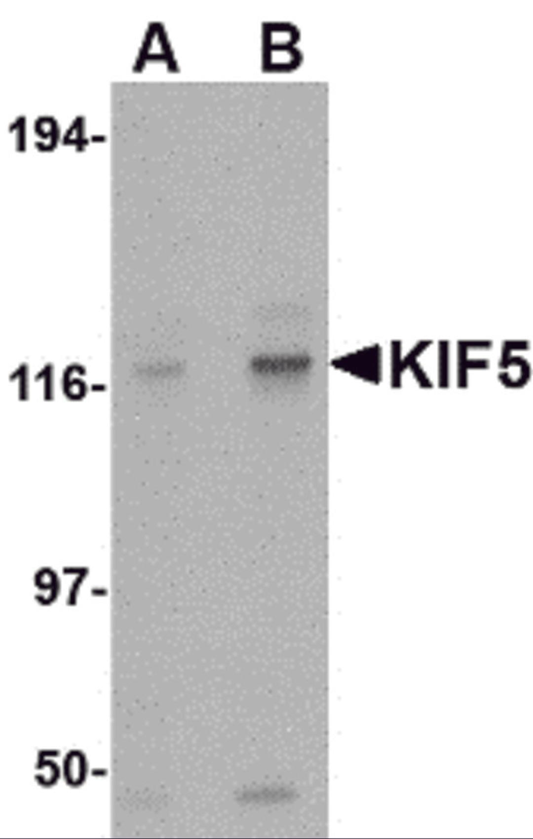 Western blot analysis of KIF5 in K562 cell lysate with KIF5 antibody at (A) 0.5 and (B) 1 &#956;g/mL.