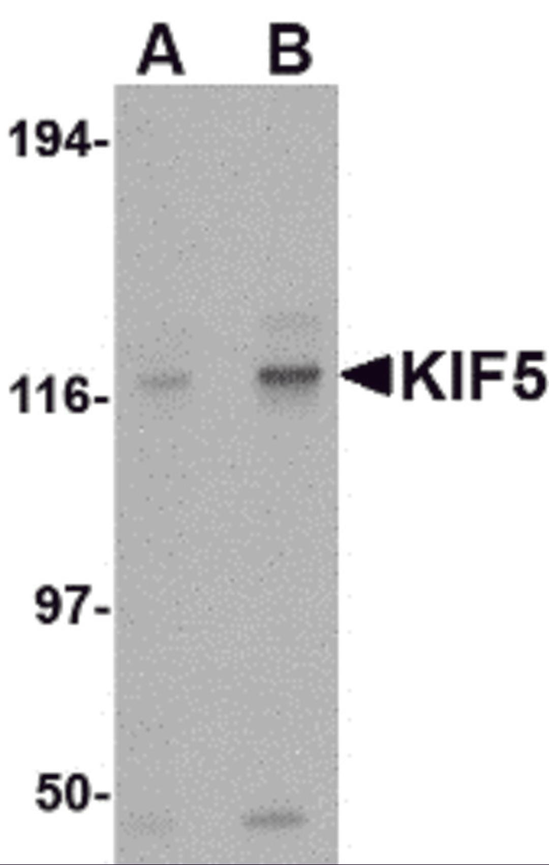 Western blot analysis of KIF5 in K562 cell lysate with KIF5 antibody at (A) 0.5 and (B) 1 μg/mL.