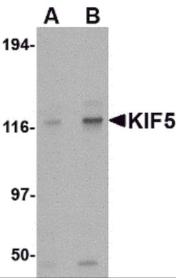 Western blot analysis of KIF5 in K562 cell lysate with KIF5 antibody at (A) 0.5 and (B) 1 μg/mL.