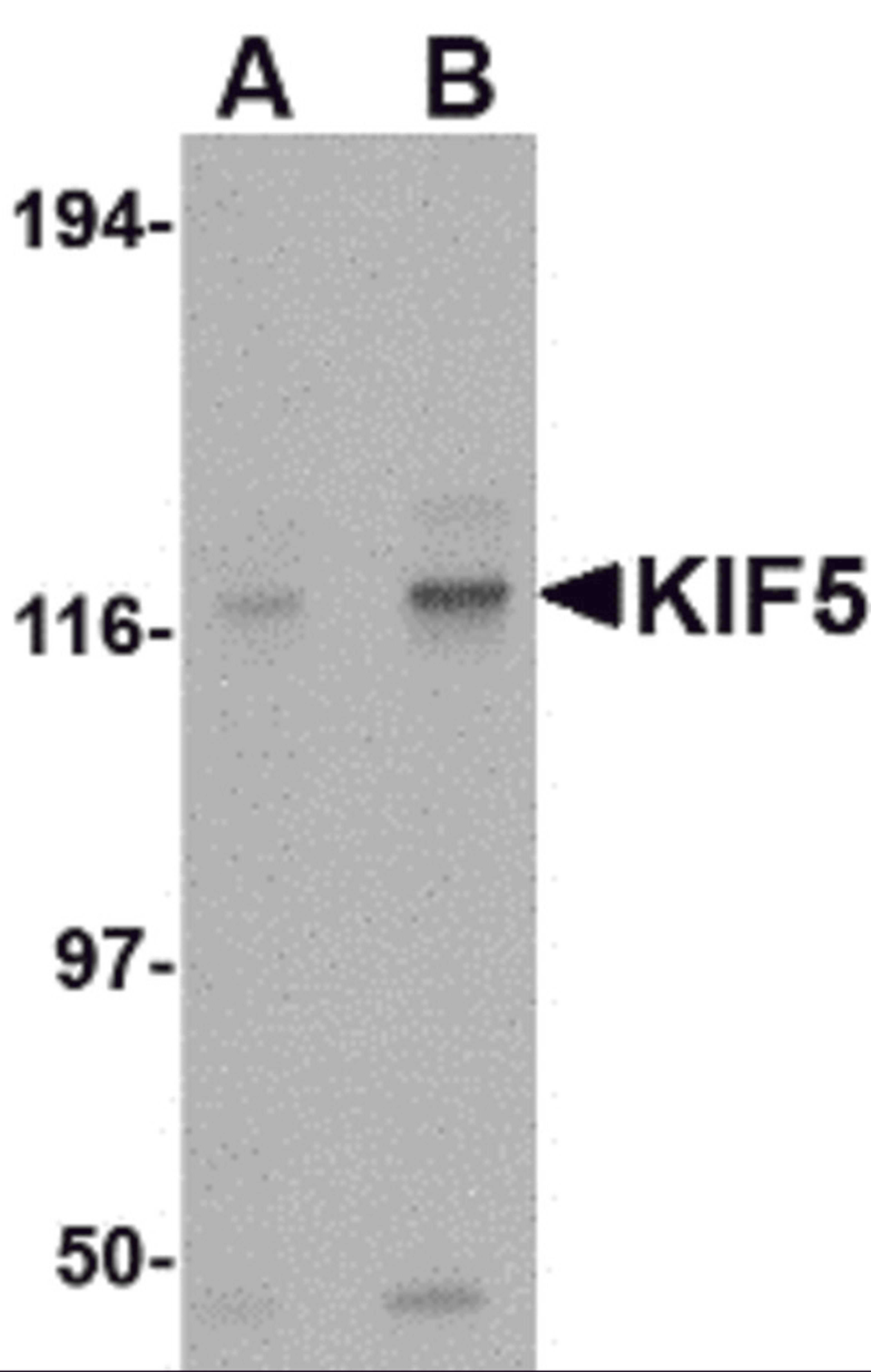 Western blot analysis of KIF5 in K562 cell lysate with KIF5 antibody at (A) 0.5 and (B) 1 μg/mL.