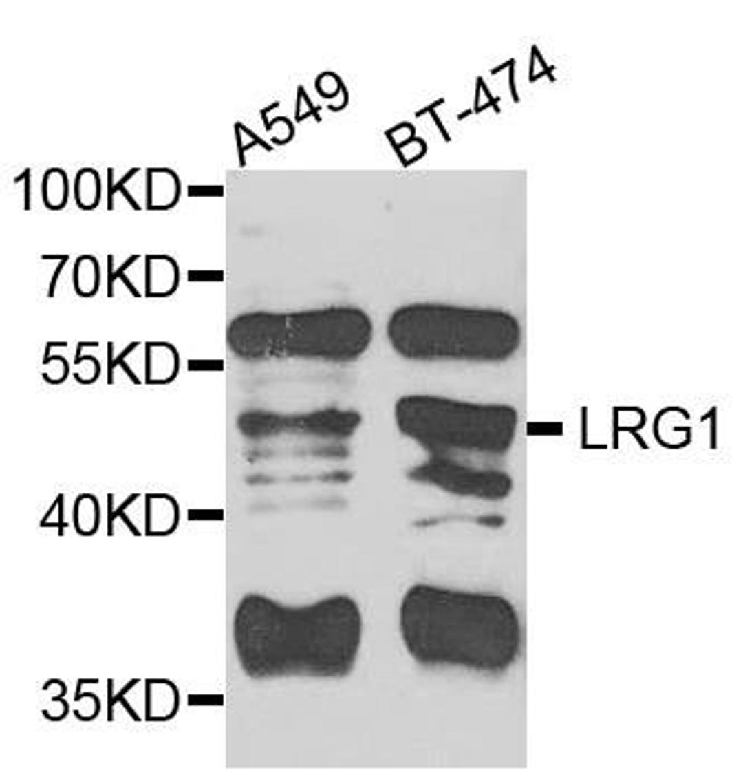 Western blot analysis of extracts of various cells using LRG1 antibody