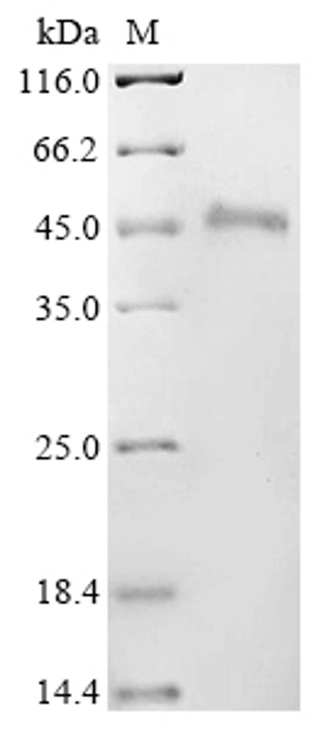 (Tris-Glycine gel) Discontinuous SDS-PAGE (reduced) with 5% enrichment gel and 15% separation gel.