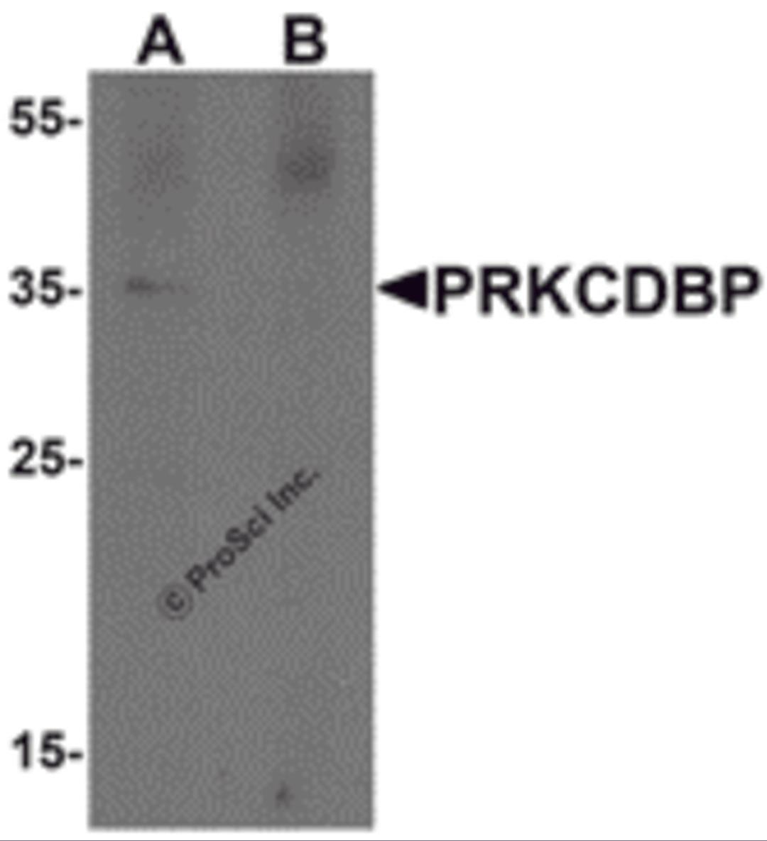 Western blot analysis of PRKCDBP in A20 cell lysate with PRKCDBP antibody at 1 μg/mL in (A) the absence and (B) the presence of blocking peptide.