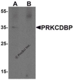 Western blot analysis of PRKCDBP in A20 cell lysate with PRKCDBP antibody at 1 μg/mL in (A) the absence and (B) the presence of blocking peptide.