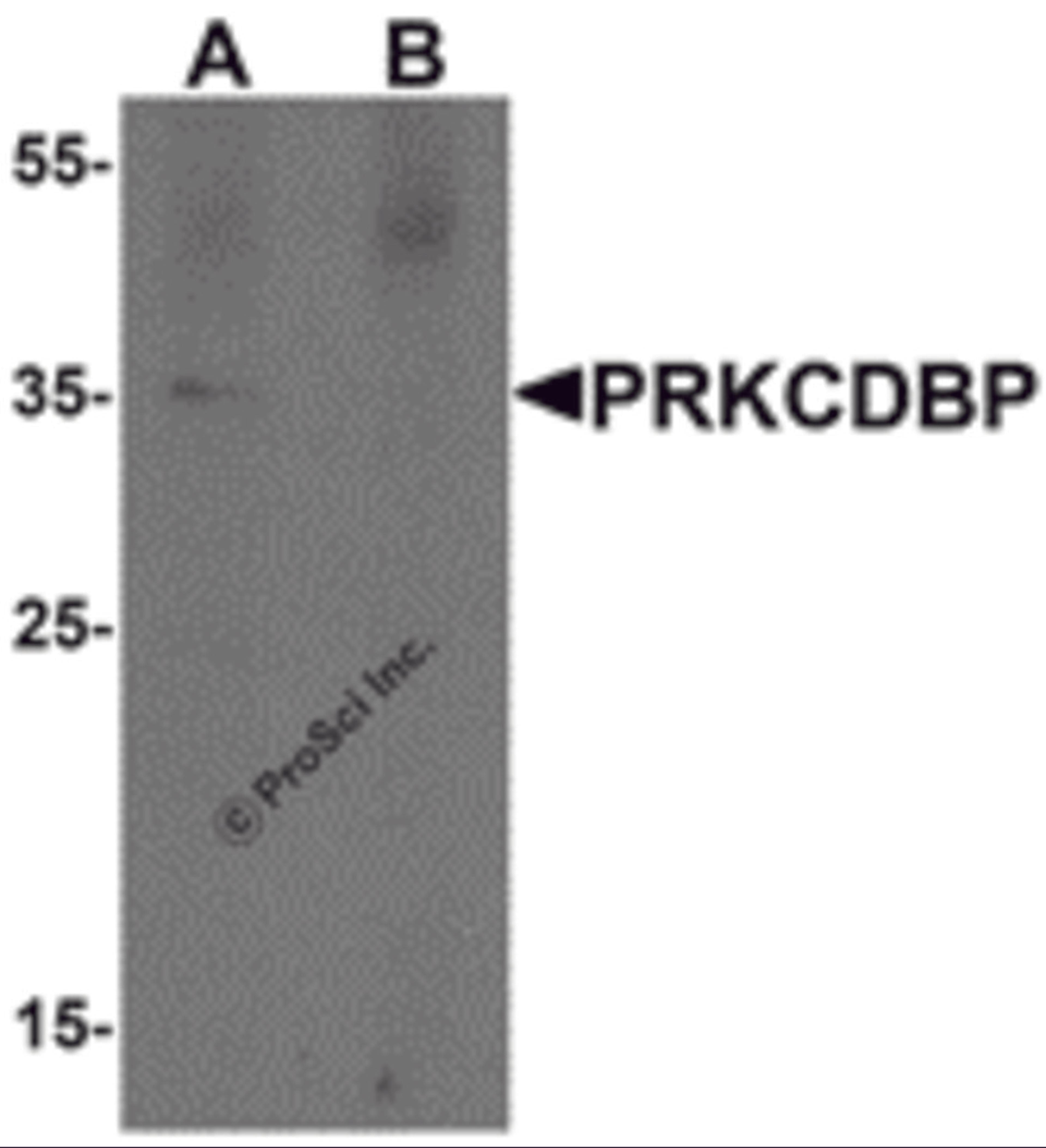 Western blot analysis of PRKCDBP in A20 cell lysate with PRKCDBP antibody at 1 μg/mL in (A) the absence and (B) the presence of blocking peptide.