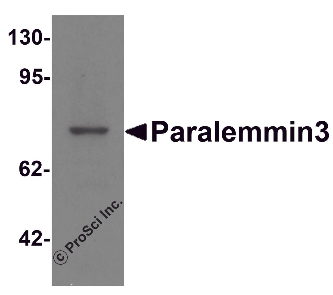 Western blot analysis of Paralemmin3 in MCF7 cell lysate with Paralemmin3 antibody at 1 μg/mL.